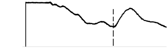 無(wú)內部平衡網(wǎng)絡(luò ),儀器增益過(guò)大